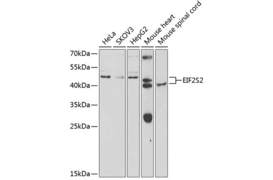 Western Blot - Anti-EIF2S2 Antibody (A5894) - Antibodies.com