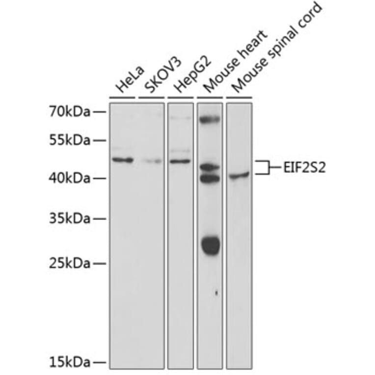 Western Blot - Anti-EIF2S2 Antibody (A5894) - Antibodies.com