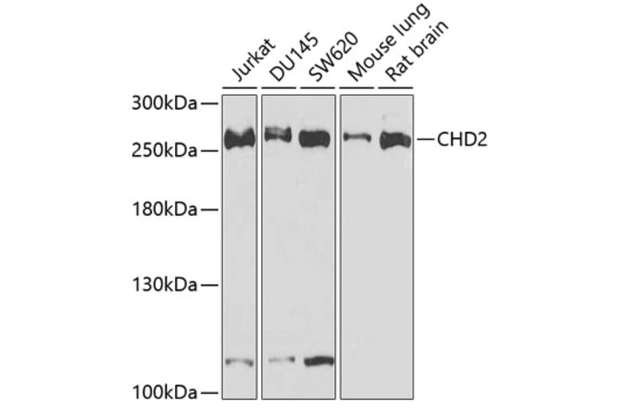 Western Blot - Anti-CHD2 Antibody (A15044) - Antibodies.com