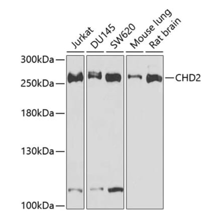 Western Blot - Anti-CHD2 Antibody (A15044) - Antibodies.com