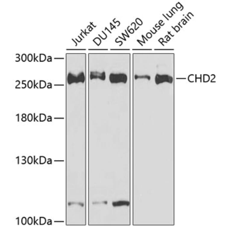 Western Blot - Anti-CHD2 Antibody (A15044) - Antibodies.com
