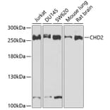 Western Blot - Anti-CHD2 Antibody (A15044) - Antibodies.com