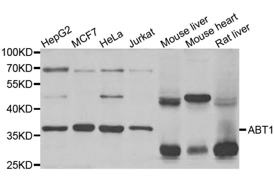 Western Blot - Anti-ABT1 Antibody (A5898) - Antibodies.com