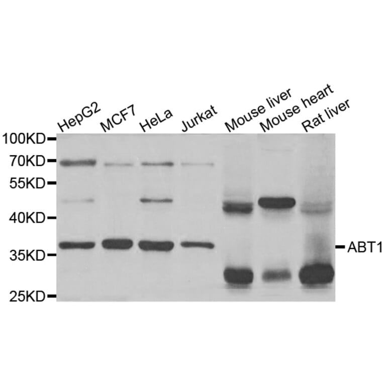 Western Blot - Anti-ABT1 Antibody (A5898) - Antibodies.com