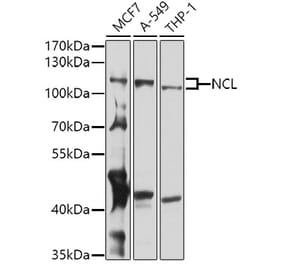 Western Blot - Anti-Nucleolin Antibody (A15046) - Antibodies.com