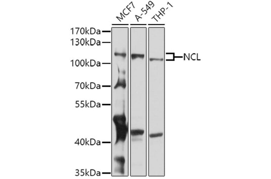 Western Blot - Anti-Nucleolin Antibody (A15046) - Antibodies.com