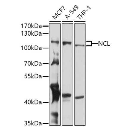 Western Blot - Anti-Nucleolin Antibody (A15046) - Antibodies.com