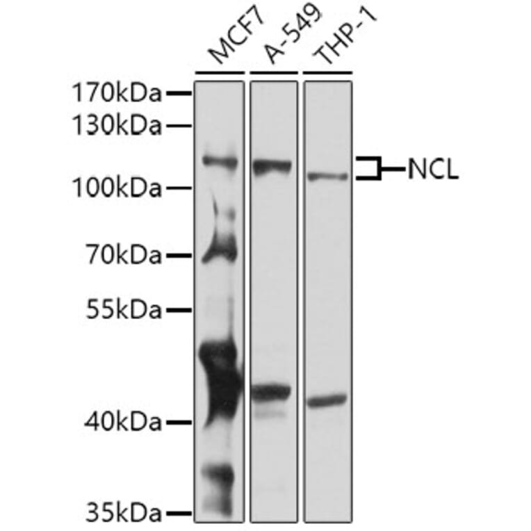 Western Blot - Anti-Nucleolin Antibody (A15046) - Antibodies.com