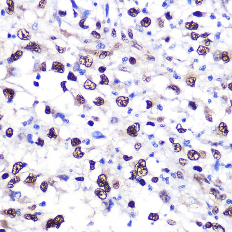 Immunohistochemistry - Anti-Nucleolin Antibody (A15046) - Antibodies.com