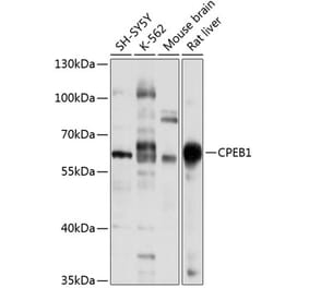 Western Blot - Anti-CPEB1 Antibody (A15048) - Antibodies.com
