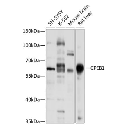 Western Blot - Anti-CPEB1 Antibody (A15048) - Antibodies.com
