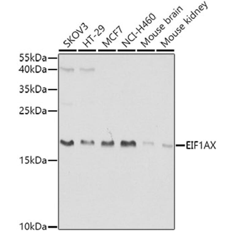 Western Blot - Anti-eIF1A Antibody (A15050) - Antibodies.com