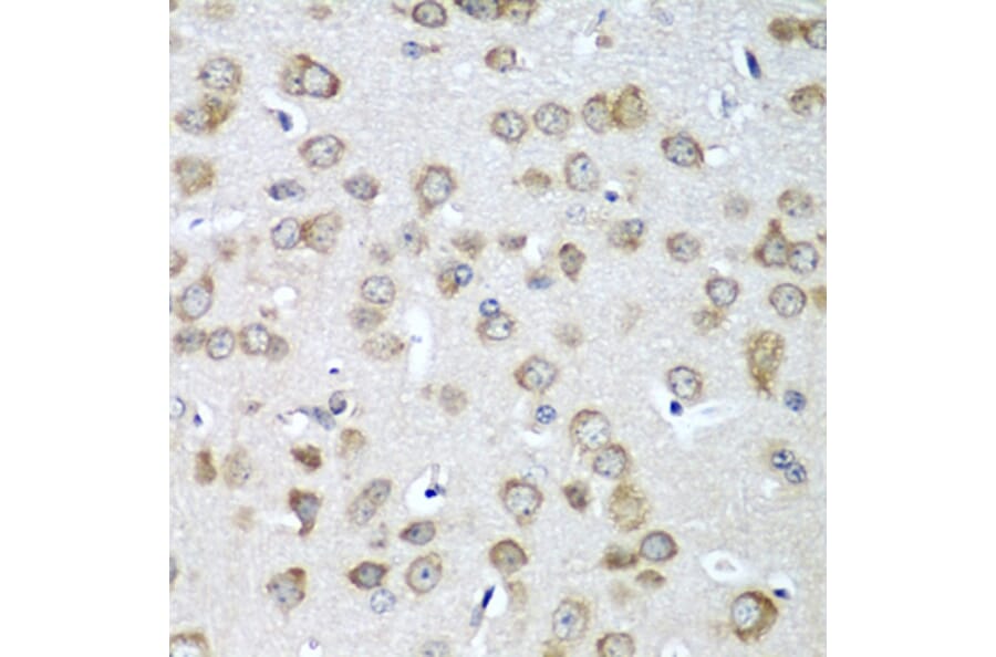 Immunohistochemistry - Anti-eIF1A Antibody (A15050) - Antibodies.com