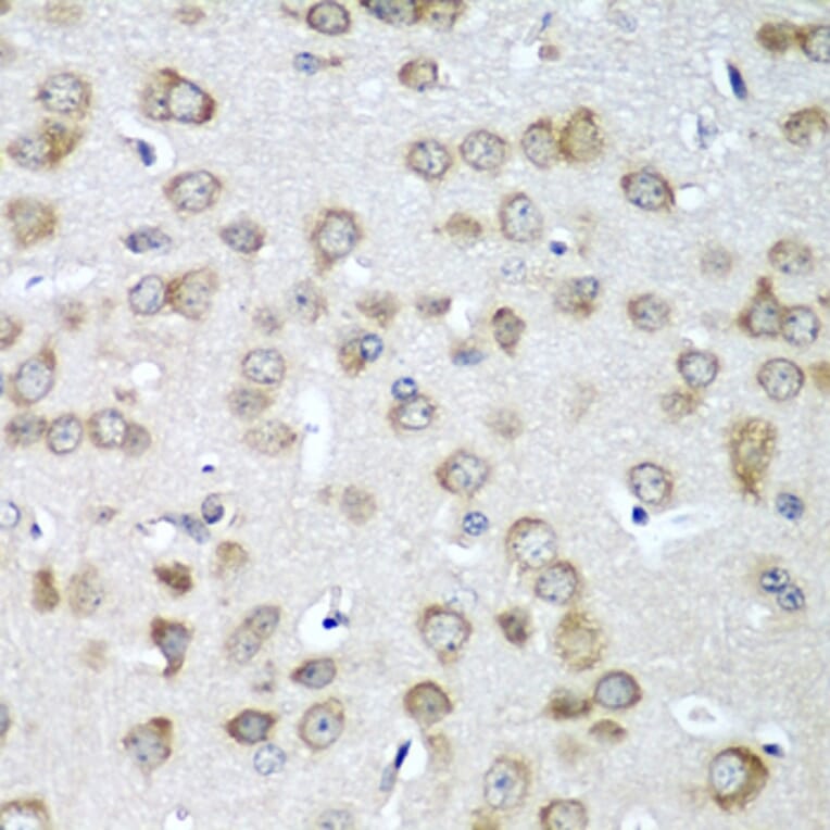 Immunohistochemistry - Anti-eIF1A Antibody (A15050) - Antibodies.com