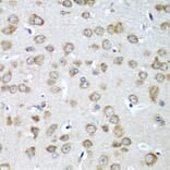 Immunohistochemistry - Anti-eIF1A Antibody (A15050) - Antibodies.com