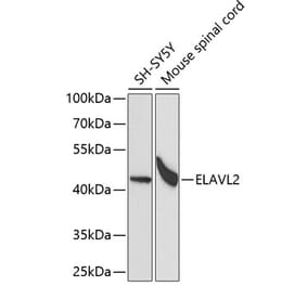 Western Blot - Anti-HuB Antibody (A15051) - Antibodies.com