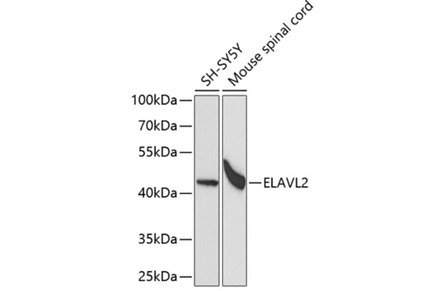 Western Blot - Anti-HuB Antibody (A15051) - Antibodies.com
