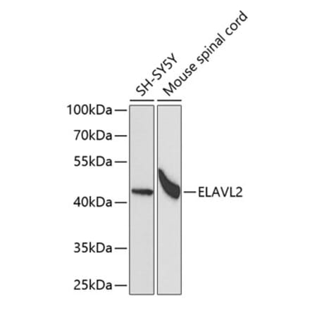 Western Blot - Anti-HuB Antibody (A15051) - Antibodies.com