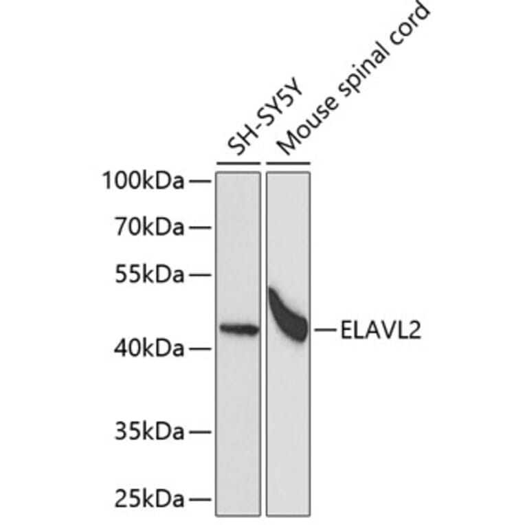 Western Blot - Anti-HuB Antibody (A15051) - Antibodies.com