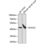Western Blot - Anti-HuB Antibody (A15051) - Antibodies.com