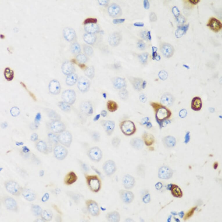 Immunohistochemistry - Anti-HuB Antibody (A15051) - Antibodies.com