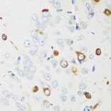 Immunohistochemistry - Anti-HuB Antibody (A15051) - Antibodies.com