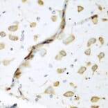 Immunohistochemistry - Anti-HuB Antibody (A15051) - Antibodies.com