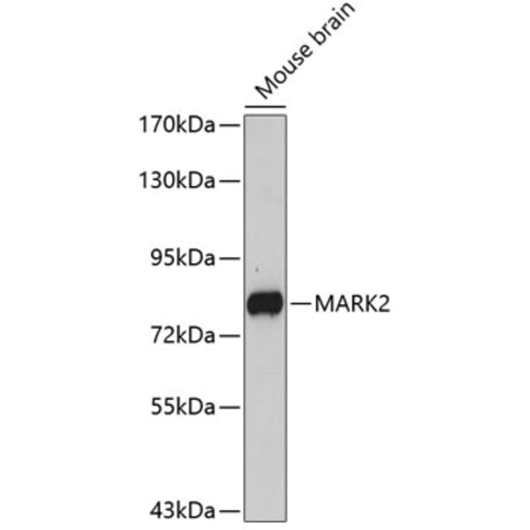 Western Blot - Anti-MARK2 Antibody (A5919) - Antibodies.com