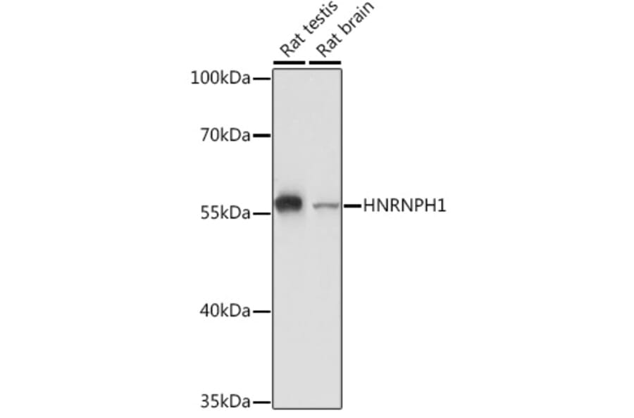 Western Blot - Anti-hnRNP H Antibody (A15054) - Antibodies.com
