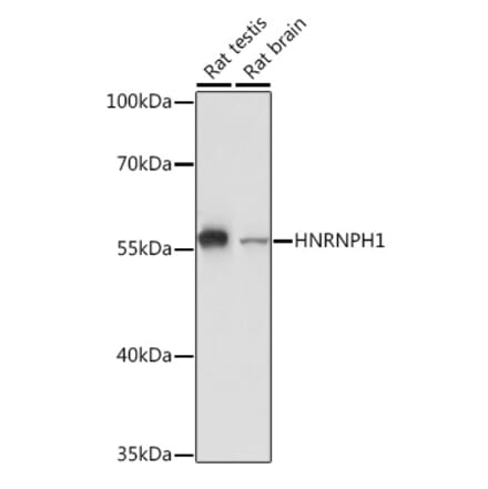 Western Blot - Anti-hnRNP H Antibody (A15054) - Antibodies.com