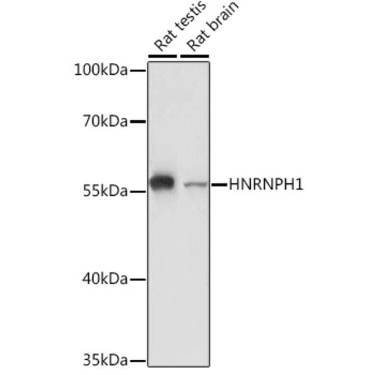 Western Blot - Anti-hnRNP H Antibody (A15054) - Antibodies.com