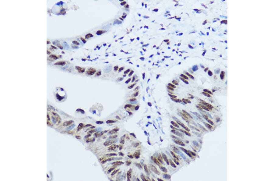 Immunohistochemistry - Anti-hnRNP H Antibody (A15054) - Antibodies.com