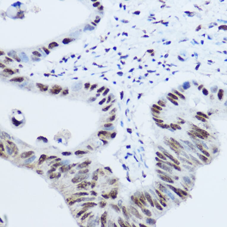 Immunohistochemistry - Anti-hnRNP H Antibody (A15054) - Antibodies.com