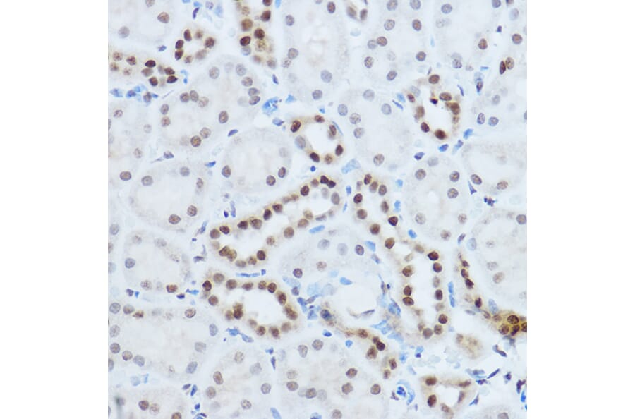 Immunohistochemistry - Anti-hnRNP H Antibody (A15054) - Antibodies.com