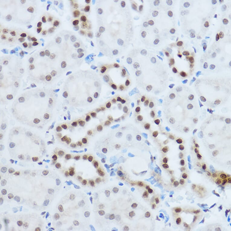 Immunohistochemistry - Anti-hnRNP H Antibody (A15054) - Antibodies.com