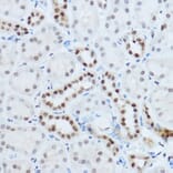Immunohistochemistry - Anti-hnRNP H Antibody (A15054) - Antibodies.com