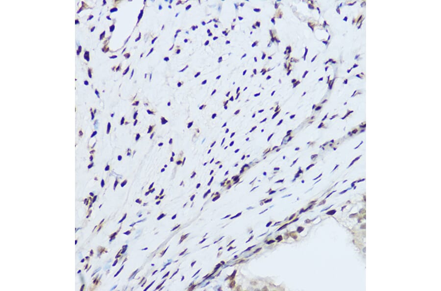 Immunohistochemistry - Anti-hnRNP H Antibody (A15054) - Antibodies.com