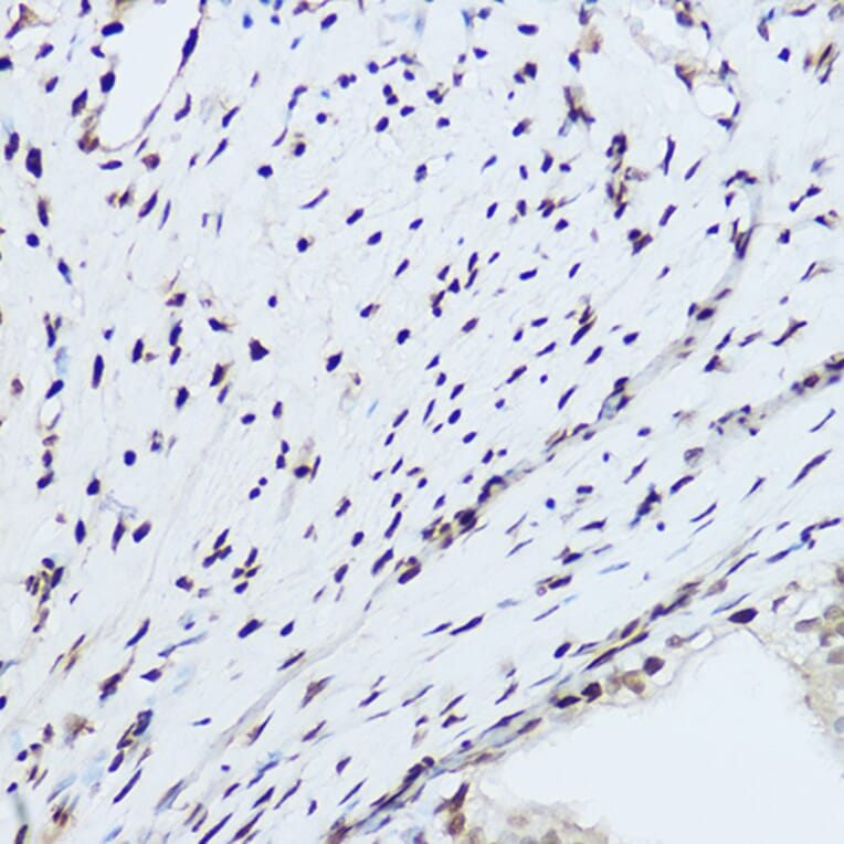 Immunohistochemistry - Anti-hnRNP H Antibody (A15054) - Antibodies.com