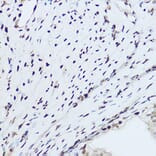 Immunohistochemistry - Anti-hnRNP H Antibody (A15054) - Antibodies.com