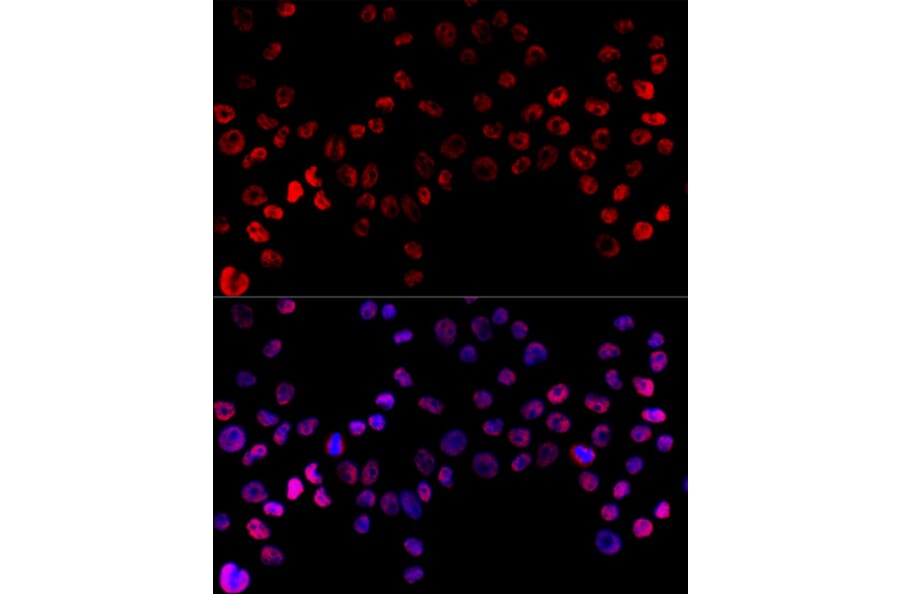 Immunofluorescence - Anti-hnRNP H Antibody (A15054) - Antibodies.com