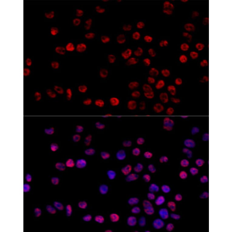 Immunofluorescence - Anti-hnRNP H Antibody (A15054) - Antibodies.com