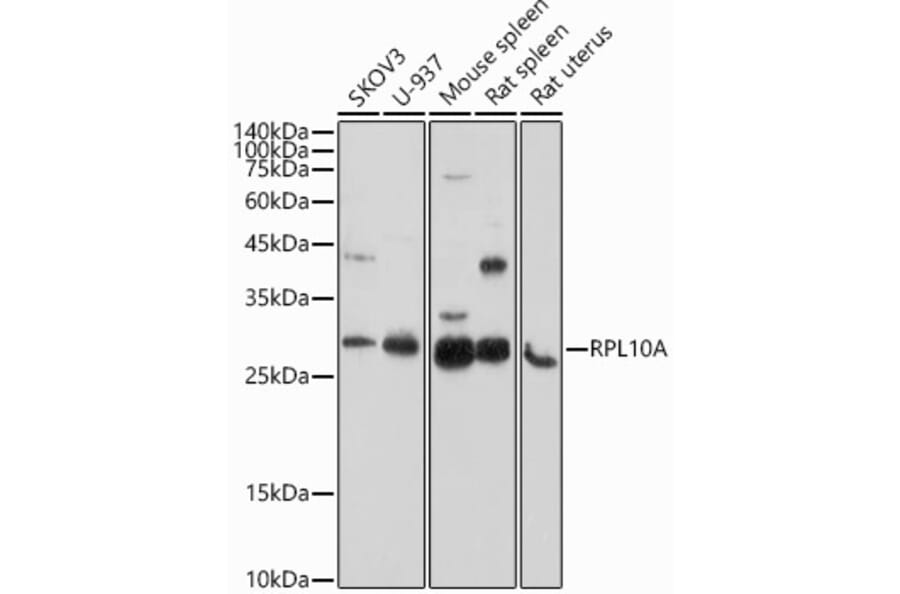 Western Blot - Anti-RPL10A Antibody (A15055) - Antibodies.com