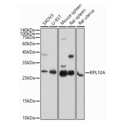 Western Blot - Anti-RPL10A Antibody (A15055) - Antibodies.com