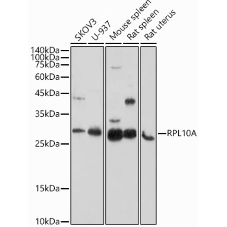 Western Blot - Anti-RPL10A Antibody (A15055) - Antibodies.com
