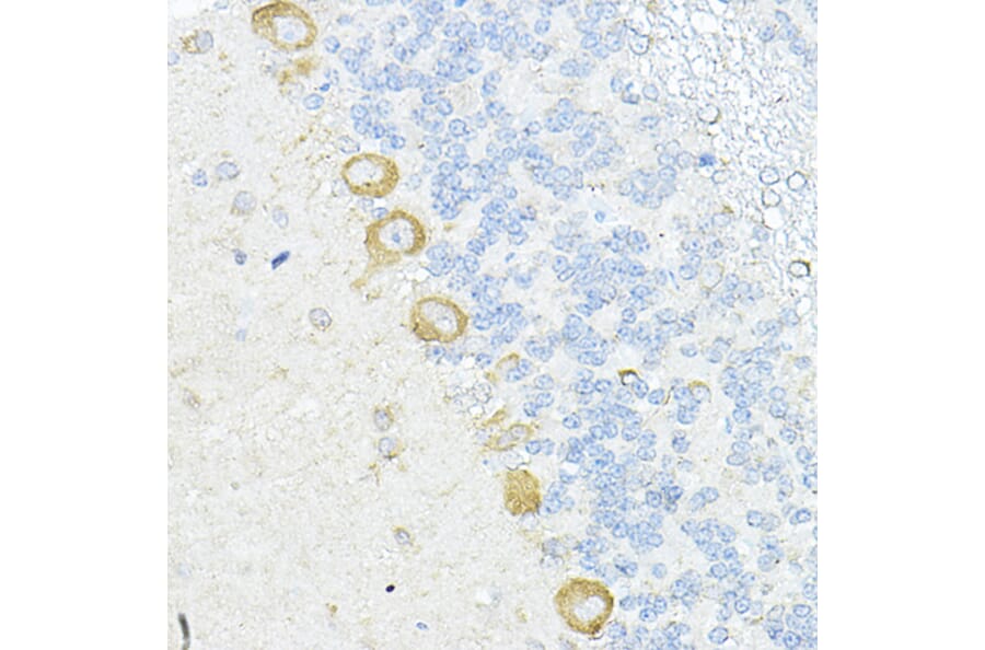 Immunohistochemistry - Anti-RPL10A Antibody (A15055) - Antibodies.com