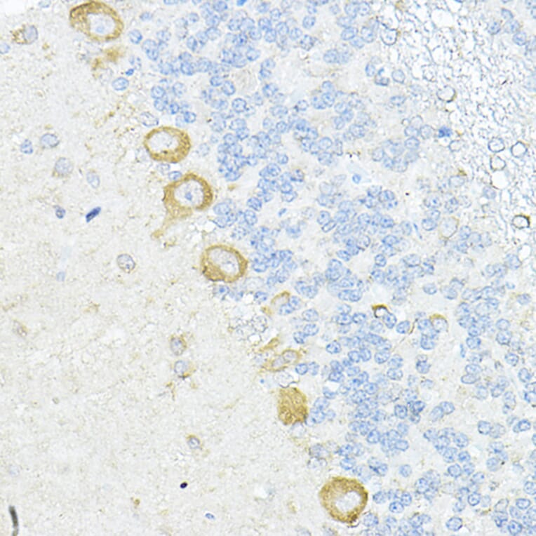 Immunohistochemistry - Anti-RPL10A Antibody (A15055) - Antibodies.com