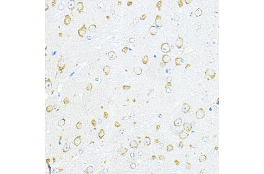 Immunohistochemistry - Anti-RPL10A Antibody (A15055) - Antibodies.com