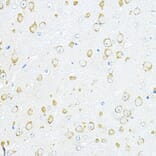 Immunohistochemistry - Anti-RPL10A Antibody (A15055) - Antibodies.com