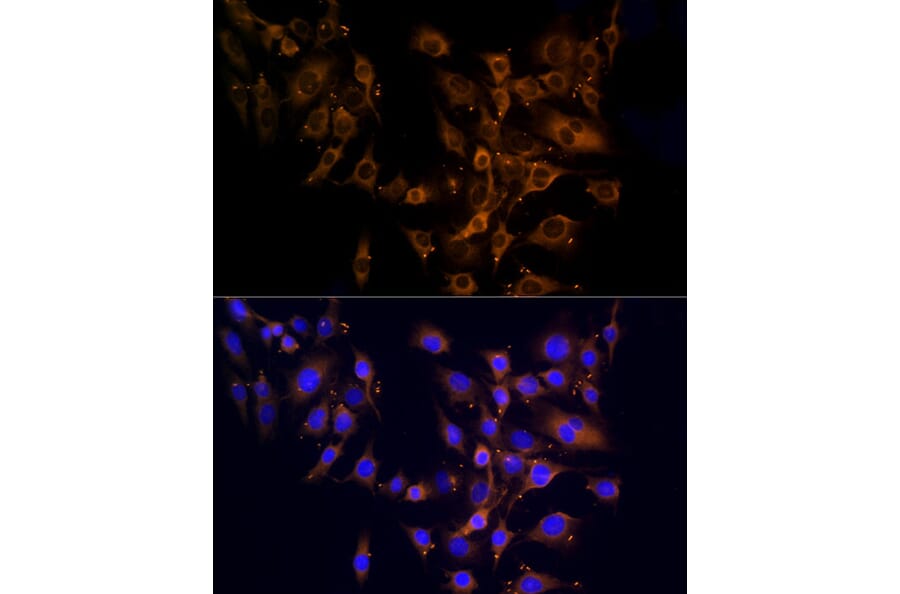 Immunofluorescence - Anti-RPL10A Antibody (A15055) - Antibodies.com