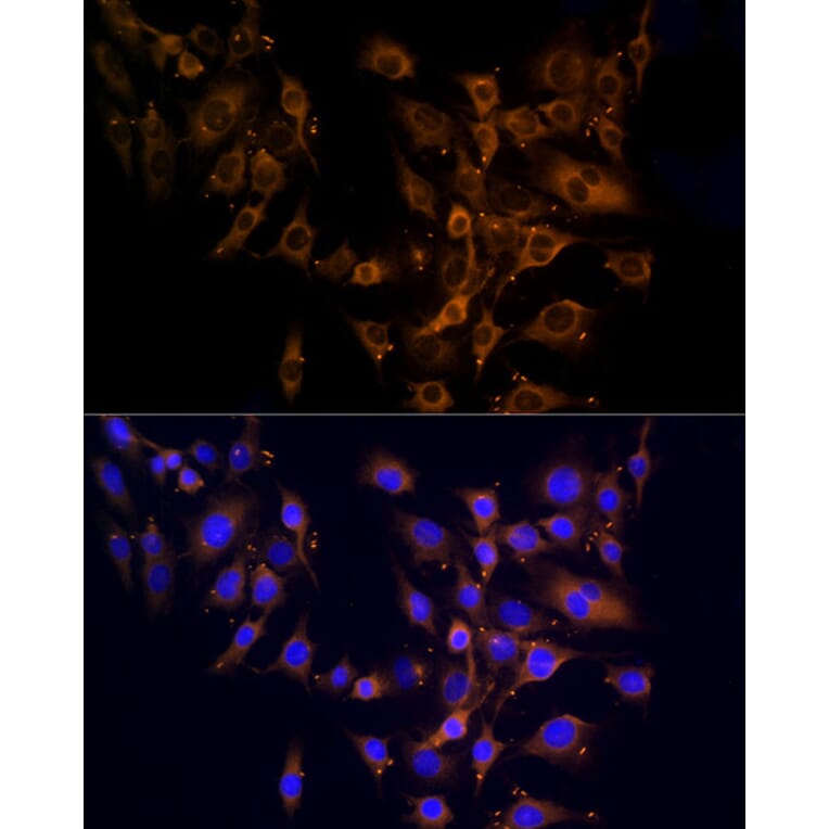 Immunofluorescence - Anti-RPL10A Antibody (A15055) - Antibodies.com